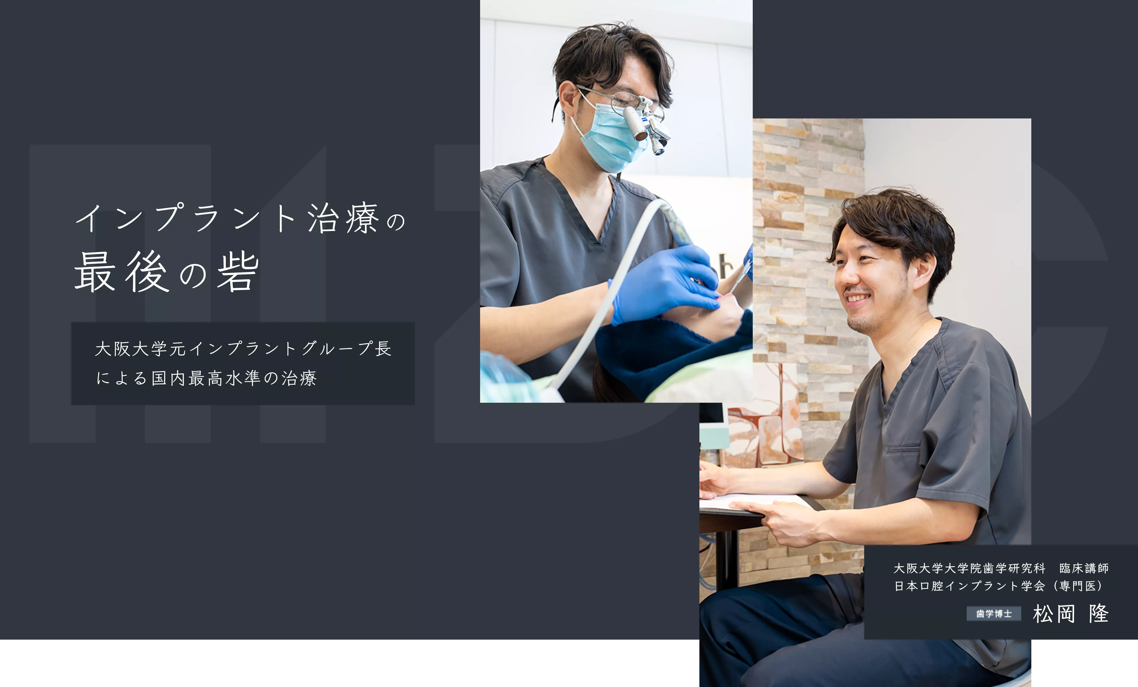 吹田・江坂でインプラント 個別無料相談 実施中！